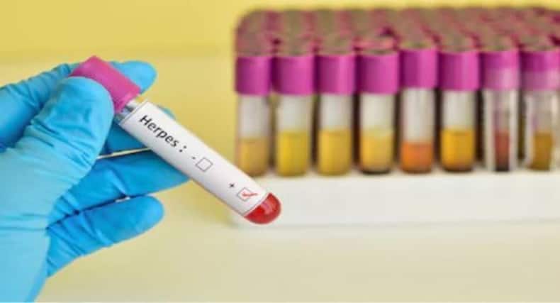 thehealthsite.com top news