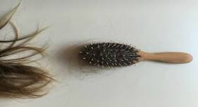 Causes of Hair Fall : ये हैं आपके द्वारा की जानें वाली गलतियां, जिनसे टूटते-झड़ते हैं बाल