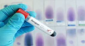 Dengue : लखनऊ में 2 महीने में डेंगू के 125 मामले सामने आए Dengue : लखनऊ में 2 महीने में डेंगू के 125 मामले सामने आए