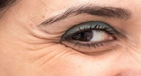 Skin care: 5 simple ways to prevent crow's feet