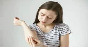 Dark Elbows : कोहनी के कालेपन को दूर करेंगे ये तीन घरेलू नुस्खे, आप भी करें ट्राई