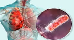 Eat these 5 foods and bid adieu to pneumonia