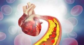 Cholesterol Level : कोलेस्ट्रॉल लेवल कंट्रोल करने के लिए अपनाएं ये आयुर्वेदिक उपाय