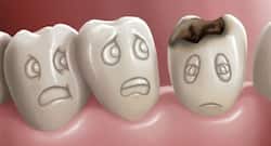 Opt for these easy ways to re-mineralise your teeth enamel