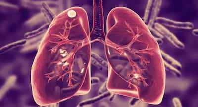 World Lung Day 2023: Be Aware Of The Most Common Diseases That Affect Your Lungs