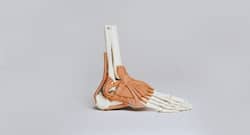 हड्डियां कमजोर हो रही हैं या कट-कट की आती है आवाज तो आज से ही अपनाएं ये घरेलू उपाय