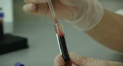 40 साल की उम्र में ही कोलोरेक्टल कैंसर का खतरा, इस आसान किट से घर पर ही कर सकते हैं जांच