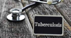Development of tuberculosis