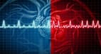 Atrial fibrillation: The reason behind your irregular heartbeat