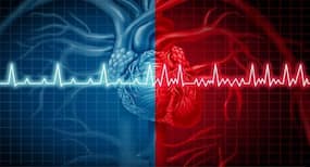 Atrial fibrillation: The reason behind your irregular heartbeat Atrial fibrillation: The reason behind your irregular heartbeat