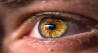 Dry Eyes Syndrome