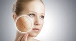 Dry Skin Care : ठंड में त्वचा पर लगाएंगी ये 5 चीजें, तो स्किन हो जाएगी ड्राई और सांवली