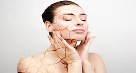 Causes of dry skin and top tips from dermatologists to treat it