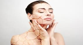 Causes of dry skin and top tips from dermatologists to treat it