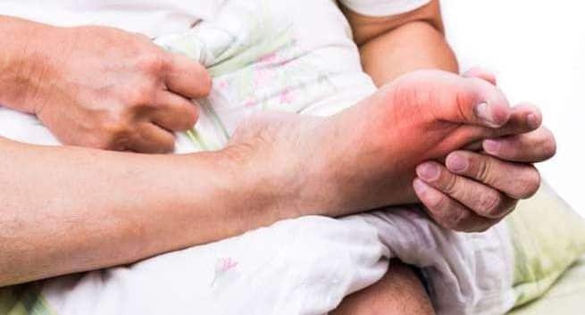 gout in india