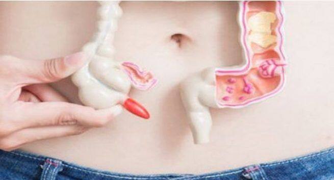 how long does colon cancer take to develop in hindi