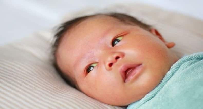 Neonatal Jaundice : जन्म के बाद शिशु को हो पीलिया, तो यूं करें इलाज