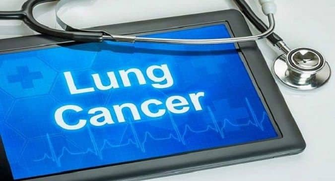 lung cancer, lung cancer signs, lung cancer treatments