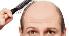 Top 10 reasons why you may be losing hair Top 10 reasons why you may be losing hair
