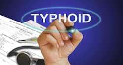 Typhoid – Causes, Symptoms, Diagnosis, Treatment and Prevention