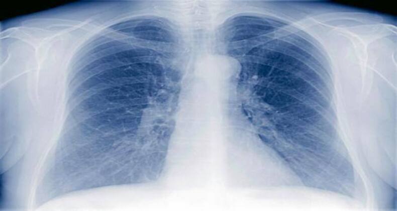 thehealthsite.com top news