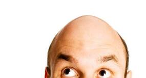 Scientists identify protein responsible for baldness