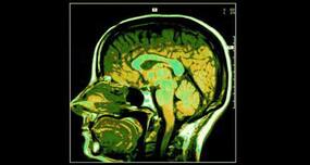 Revealed - How sodium affects your brain