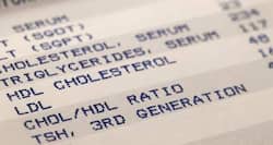 Cholesterol query of the day: Is there any risk with low HDL level?