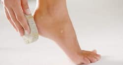 Is there any home remedy for cracked heels? (Beauty query of the day)