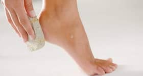 Is there any home remedy for cracked heels? (Beauty query of the day)