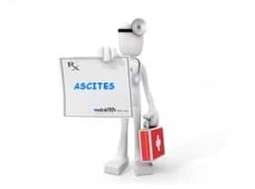 Know your medical terms: Ascites Know your medical terms: Ascites