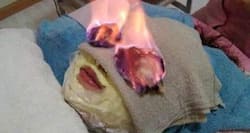 Fire facial - would you light your face on fire to look beautiful?