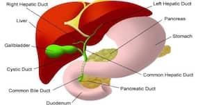 Gallstones - causes, symptoms, diagnosis and treatment