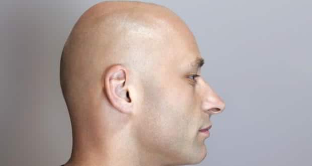 Now Conceal Hair Loss With Hair Tattoos Thehealthsite Com