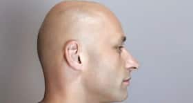 Now, conceal hair loss with hair tattoos