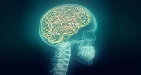 Concussions or head trauma linked to Alzheimer's disease