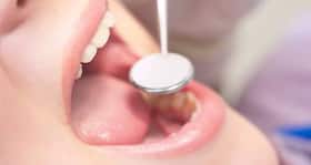 Beware - Mouth bug could lead to serious heart, brain and spinal disease