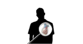 Organ donation - all your queries answered