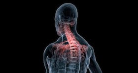 Even men can get osteoporosis