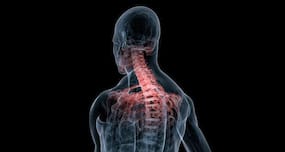 Osteoporosis: What you ought to know