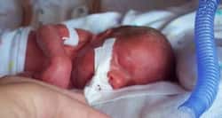 Delivered Too Soon – India’s first action report on preterm births