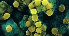 World Tuberculosis Day 2012: Urgent measures needed to control TB