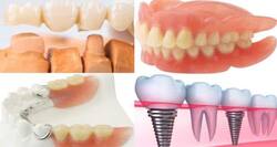 Top options to replace lost teeth