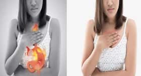 home remedy for stomach burn and acidity
