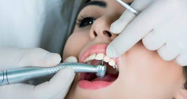 Dental fillings - what you need to know 