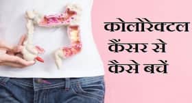 colorectal cancer causes symptoms prevention and treatment colorectal cancer causes symptoms prevention and treatment