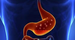 8 lifestyle tips to treat acidity