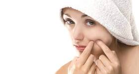 Summer, oily skin and acne - the taxing trio!