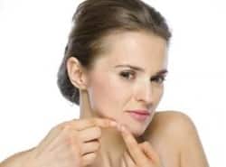 Mega guide to beat acne: Types, causes, treatments, medications and home remedies