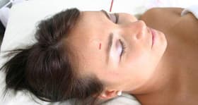 Acupuncture: All you need to know